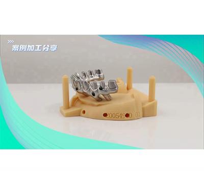 种植牙个性化桥架